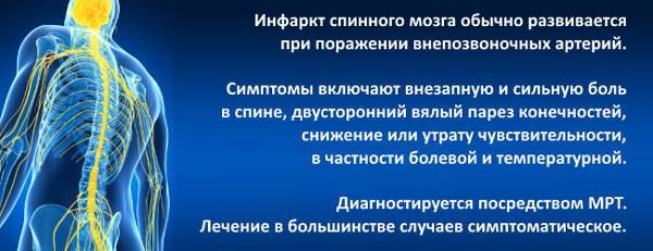 Симптомы и лечение синдрома конского хвоста в пояснице