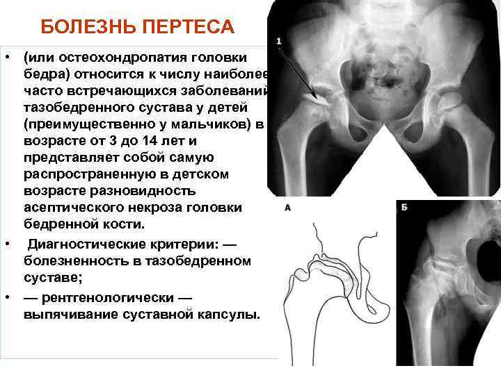 Фурункул: причины образования. стадии развития, лечение. когда с фурункулом надо обращаться к врачу