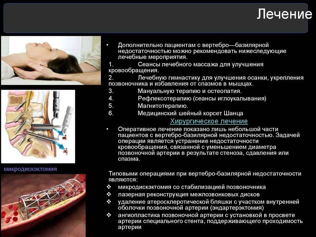 Невринома: виды, симптомы, диагностика