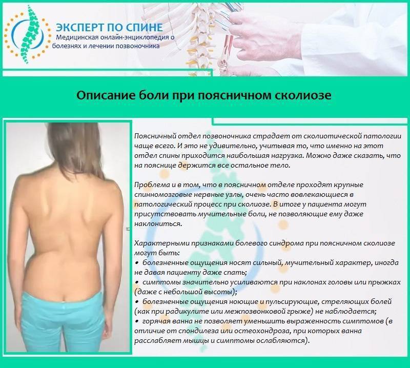 Шейный остеохондроз ️: симптомы, признаки и лечение остеохондроза шейного отдела