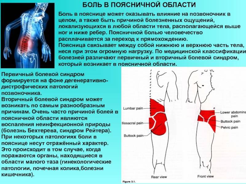 Что можно и что нельзя делать при остеохондрозе?