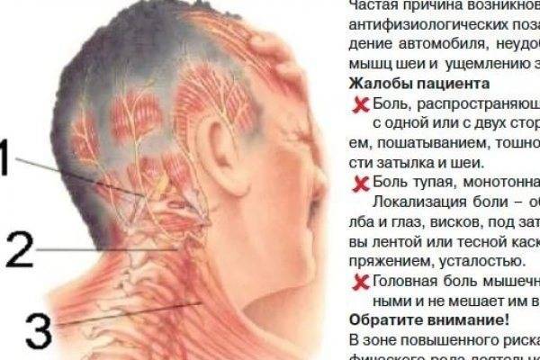 Головная боль в затылке и затылочной части головы: причины и лечение | ким