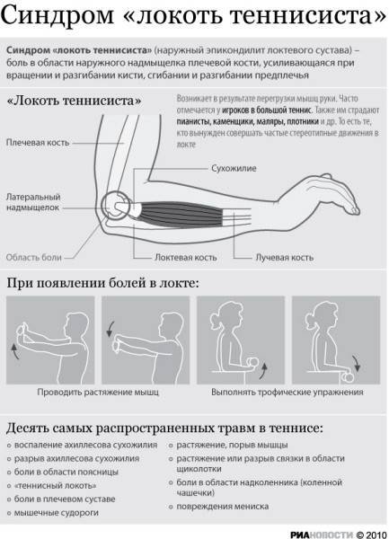 Болит локоть поднятии тяжести и других нагрузках: причина и что делать?