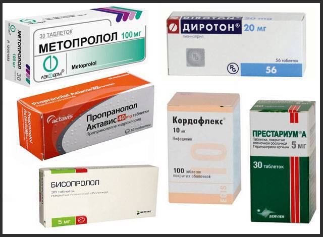 Как отличить остеохондроз от других заболеваний?